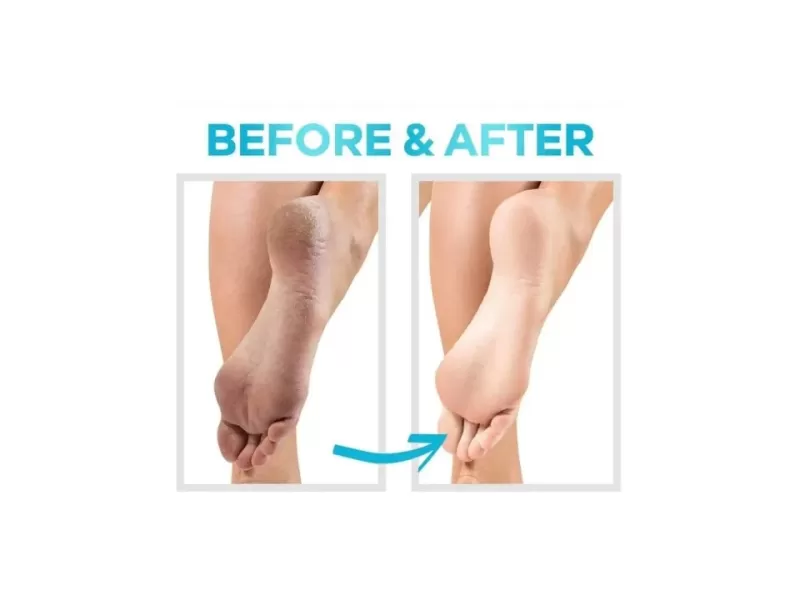 Cerave sa renewing foot cream 88ml for exteremly dry skin