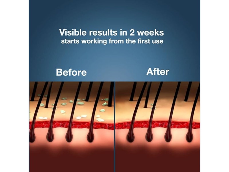 OPTIDEX-T OPHT SOLUTION 5ML