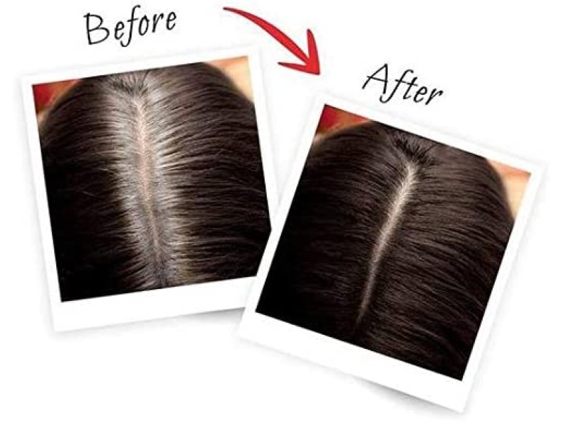 Loreal hair color magic retouch 75 ml dark brown